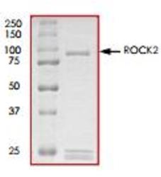 SDS-PAGE (ROCK2-26H).jpg